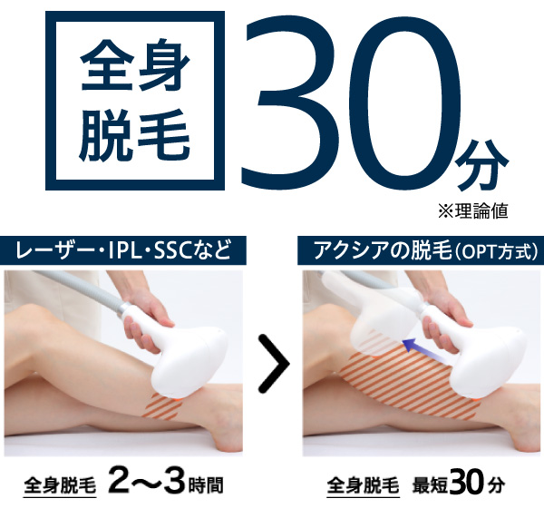 全身脱毛30分 ※理論値